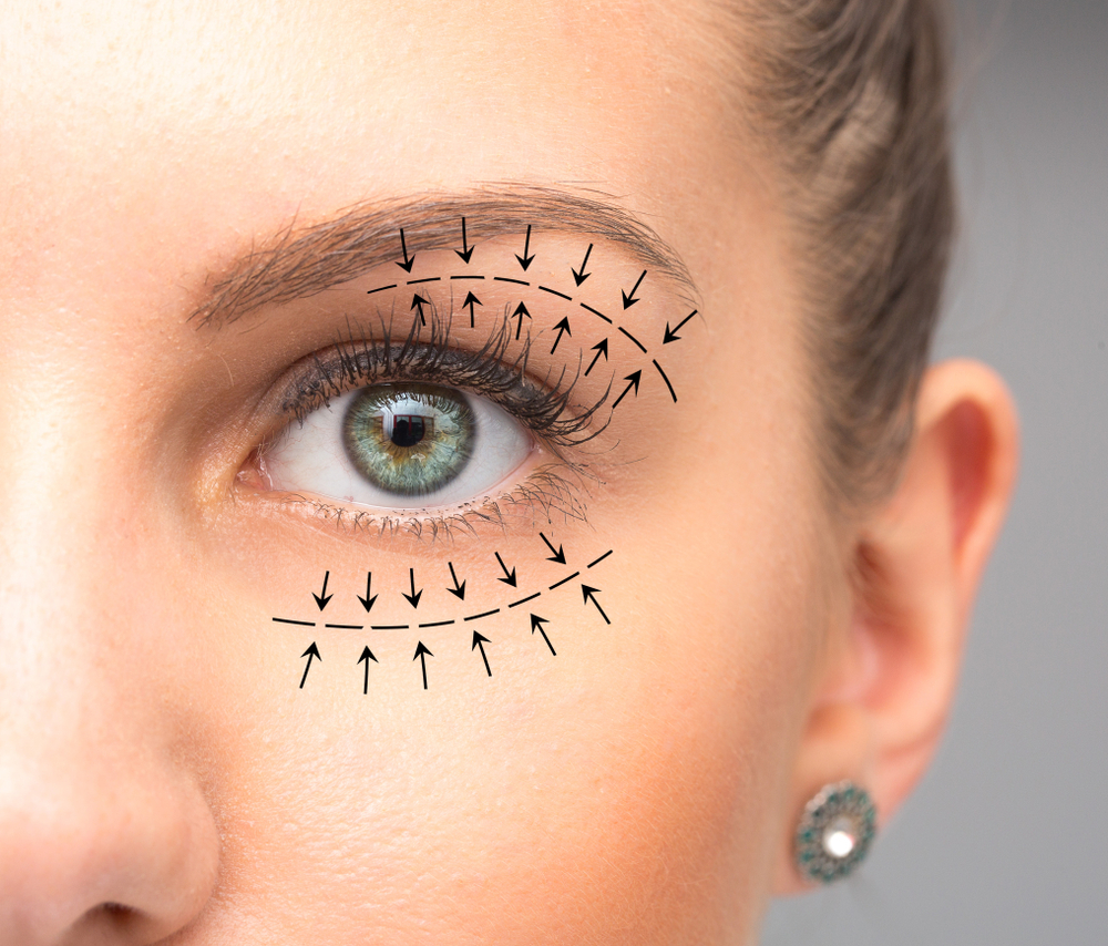 Eyes That Wow: The Rise of Eyelid Surgery | DFW Aesthetics & Cosmetic Surgery